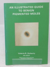 Image of An Illustrated Guide to Benign Pigmented Moles