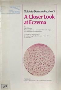 Image of Guide to Dermatology No. 3: A Closer Look At Eczema