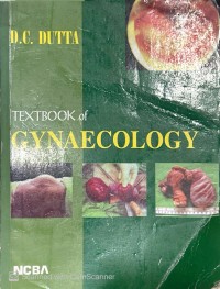 Image of Textbook of Gynaecology
